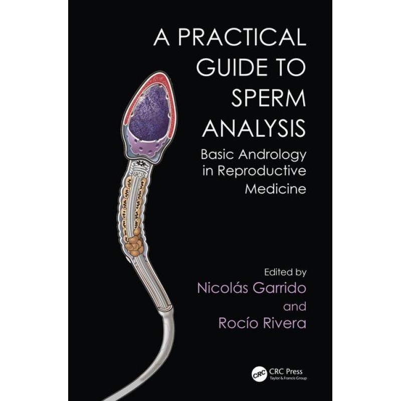 Practical Guide to Sperm Analysis: Basic Andrology in Reproductive Medicine 1st Edition