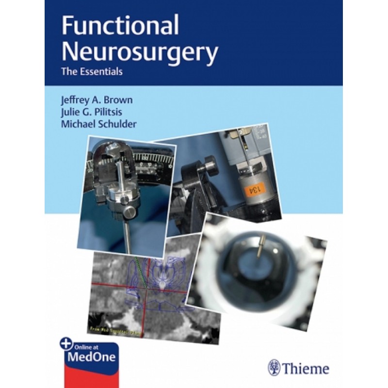 Functional Neurosurgery - The Essentials 