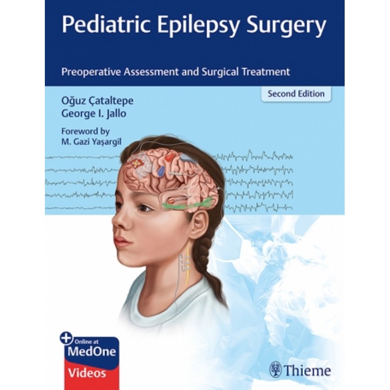 Pediatric Epilepsy Surgery