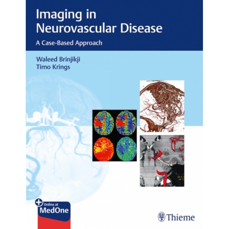 Imaging in Neurovascular Disease A Case-Based Approach 