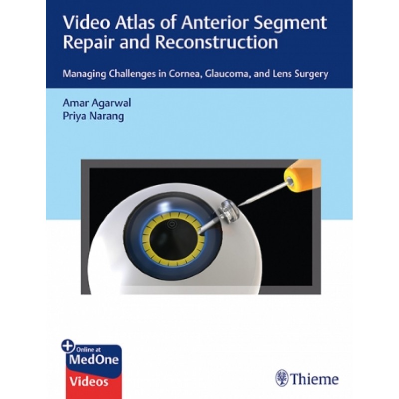 Video Atlas of Anterior Segment Repair and Reconstruction