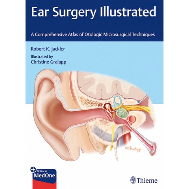 Ear Surgery Illustrated