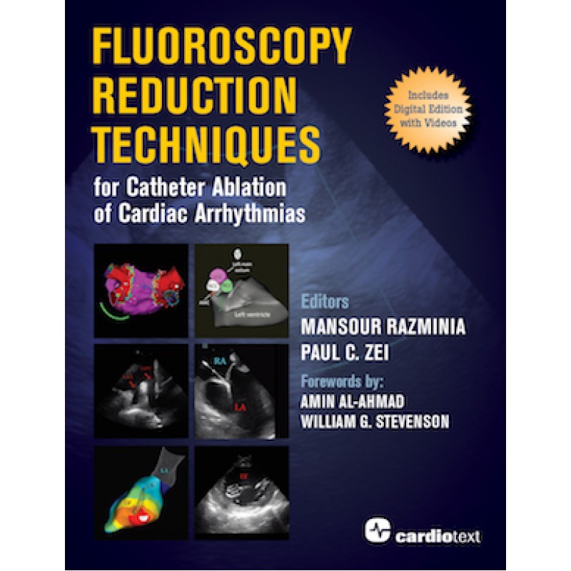 Fluoroscopy Reduction Techniques for Catheter Ablation of Cardiac Arrhythmias