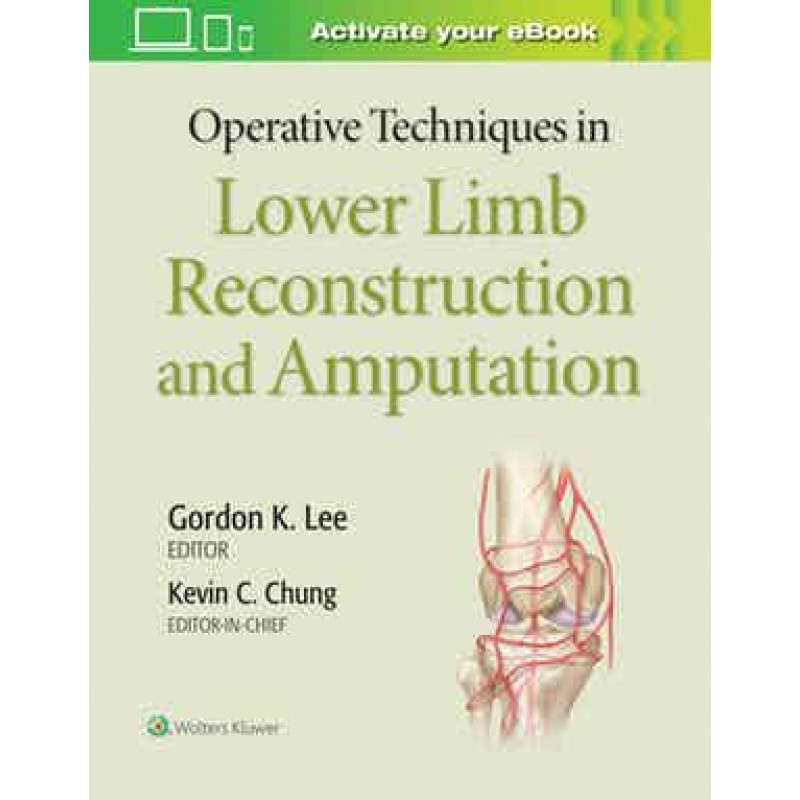 Operative Techniques in Lower Limb Reconstruction and Amputation