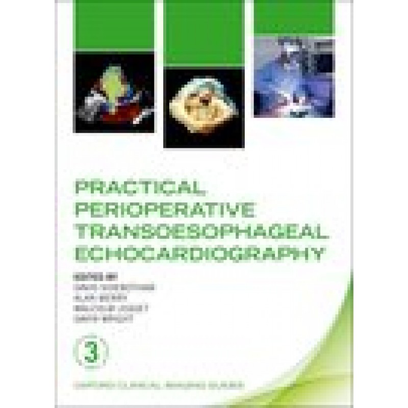 Practical Perioperative Transoesophageal Echocardiography  3ed