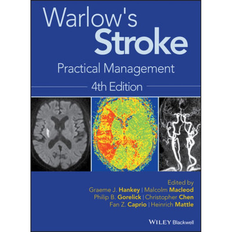 Warlow's Stroke: Practical Management, 4th Edition