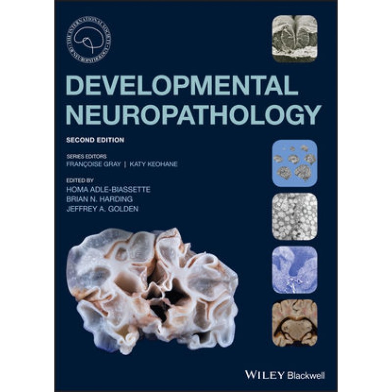 Developmental Neuropathology, 2nd Edition