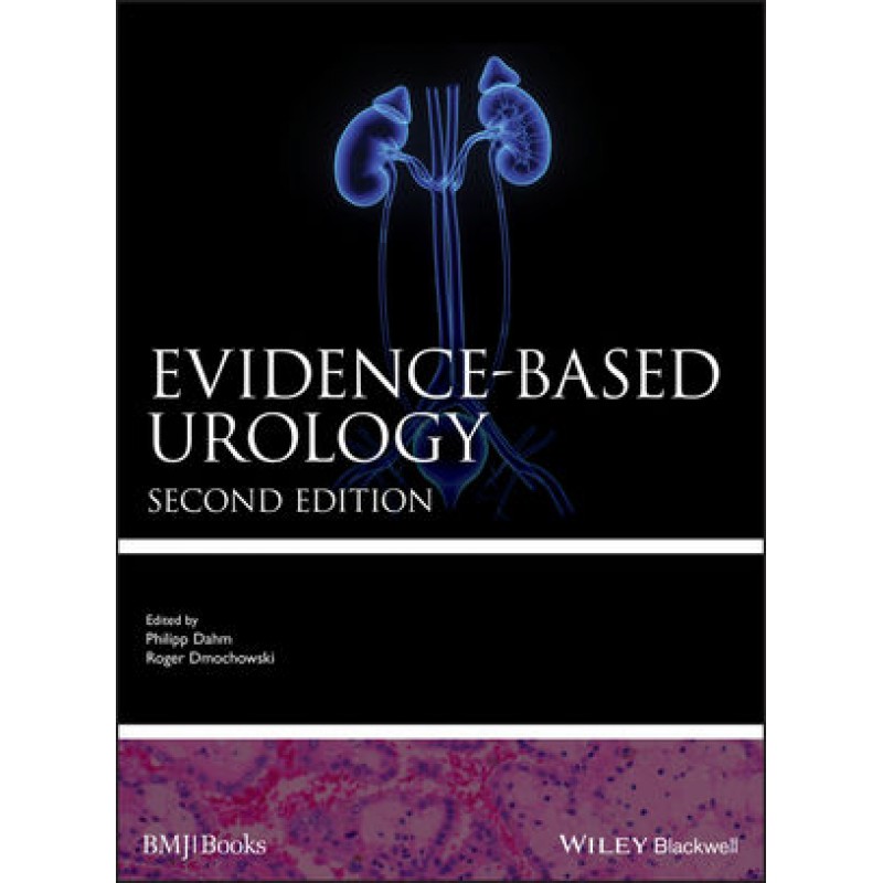 Evidence-based Urology, 2nd Edition