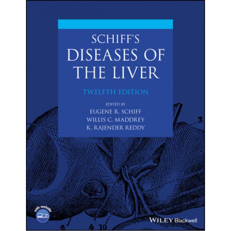 Schiff's Diseases of the Liver, 12th Edition