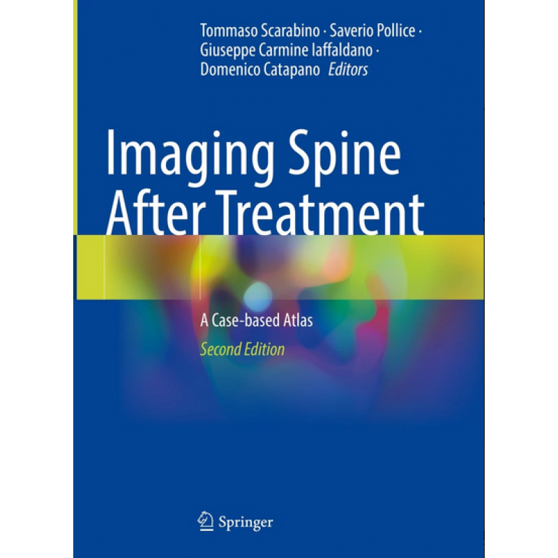 Imaging Spine After Treatment 