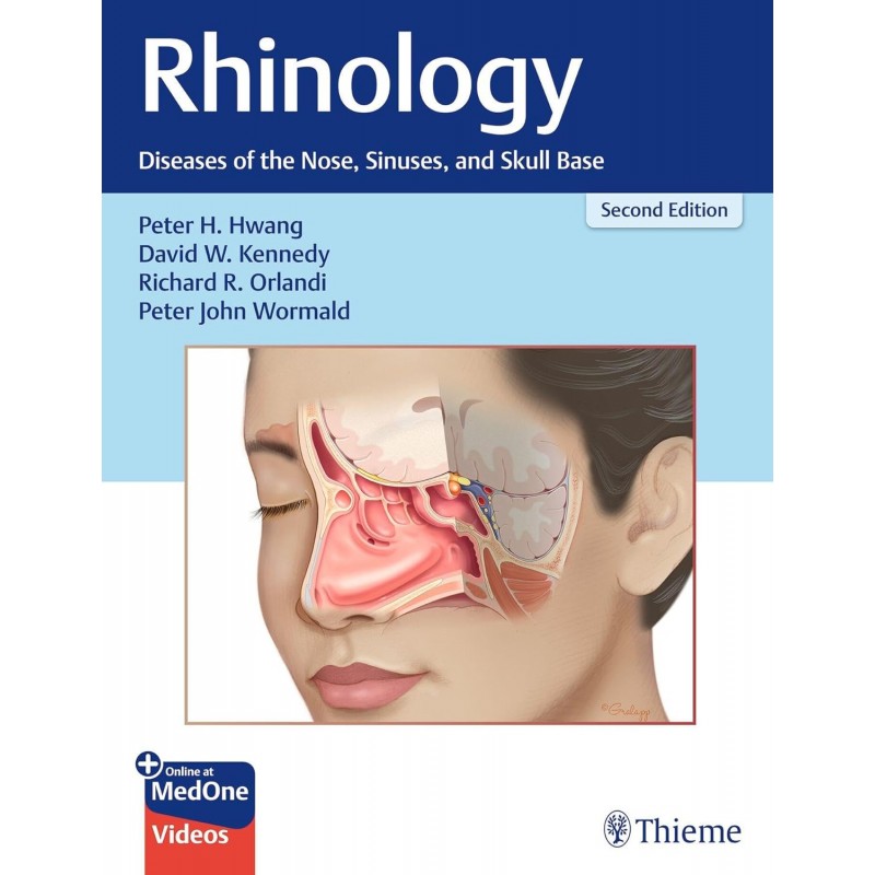 Rhinology Diseases of the Nose, Sinuses, and Skull Base 2nd edition