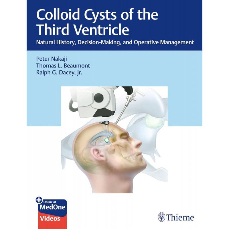 Colloid Cysts of the Third Ventricle. Natural History, Decision-Making, and Operative Management