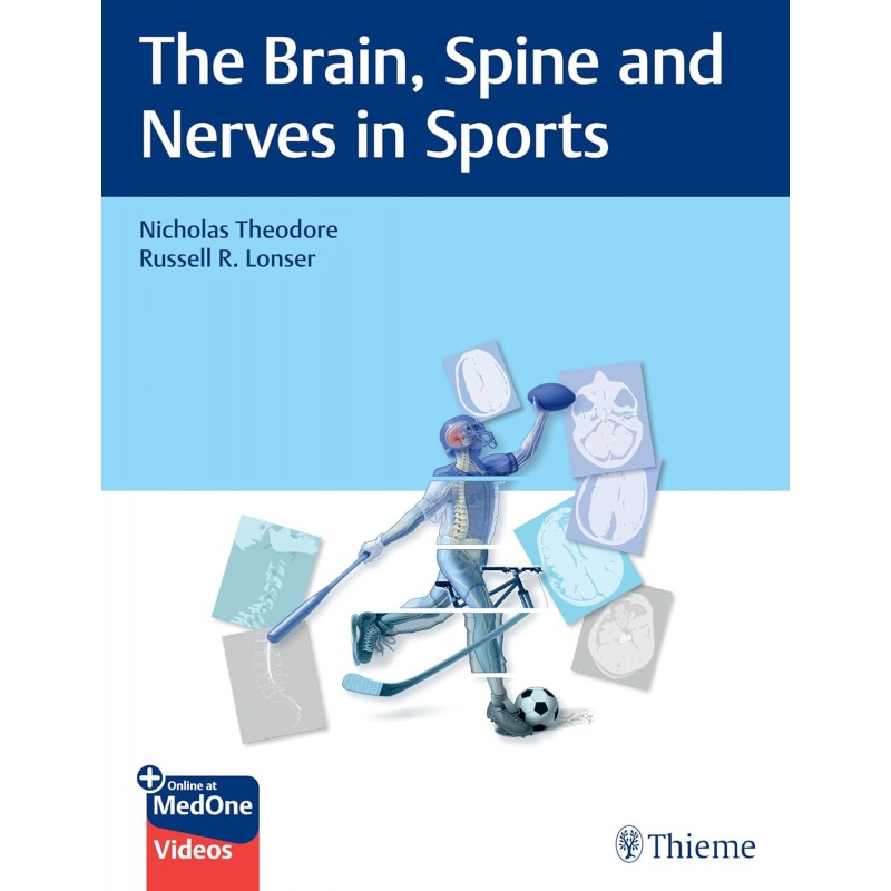 The Brain, Spine and Nerves in Sports