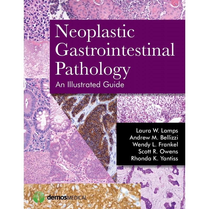 Neoplastic Gastrointestinal Pathology