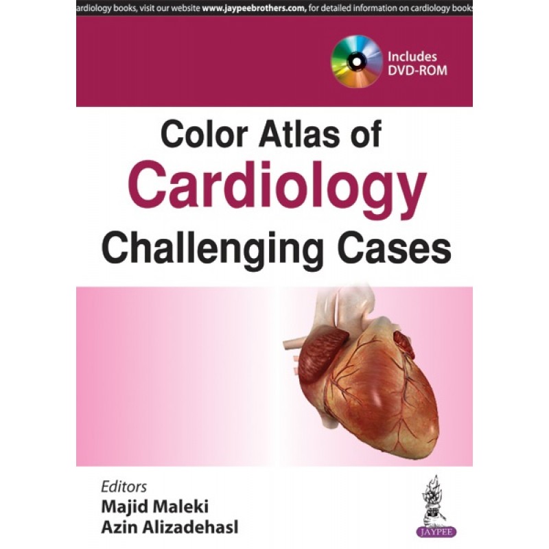 Color Atlas of Cardiology