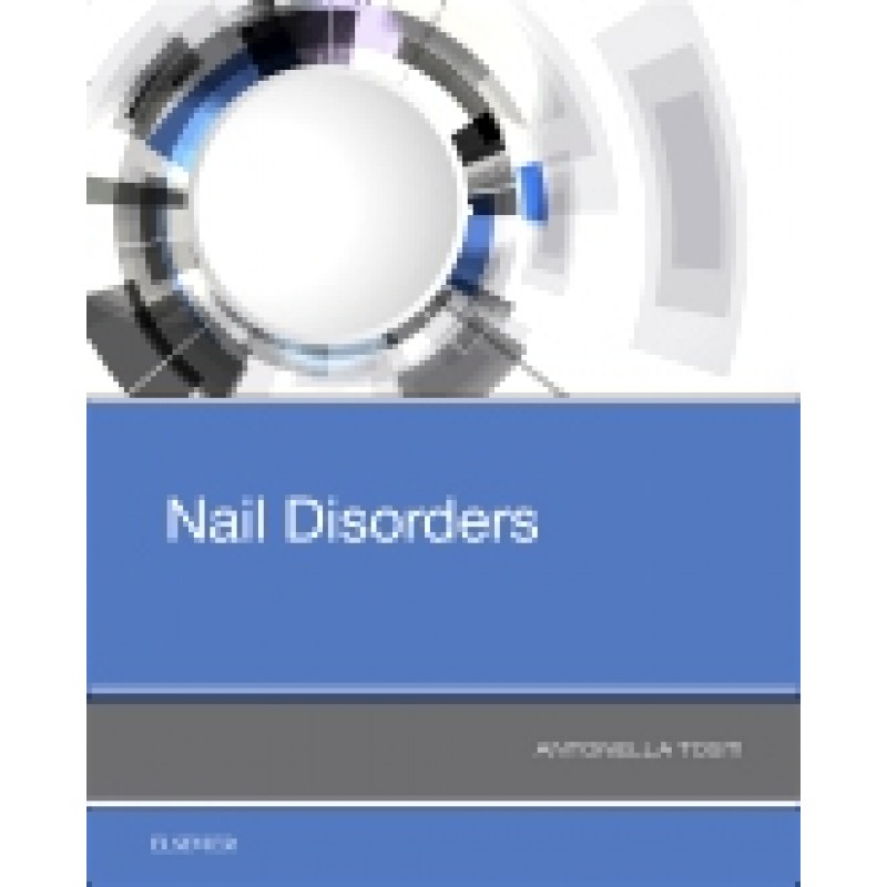 Nail Disorders