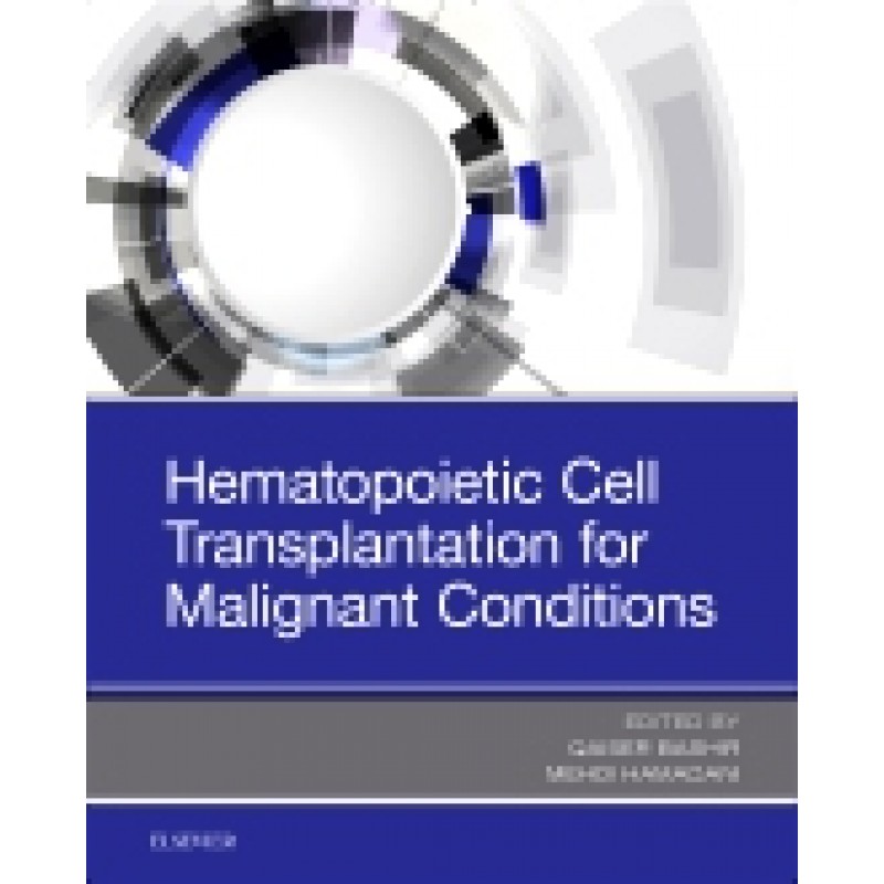 Hematopoietic Cell Transplantation for Malignant Conditions