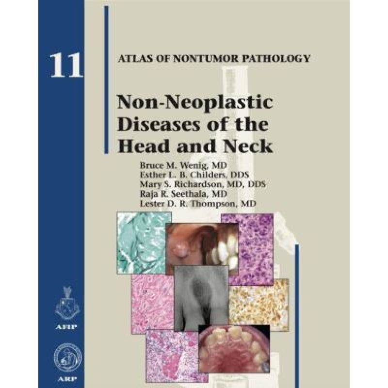 Non-Neoplastic Diseases of the Head and Neck