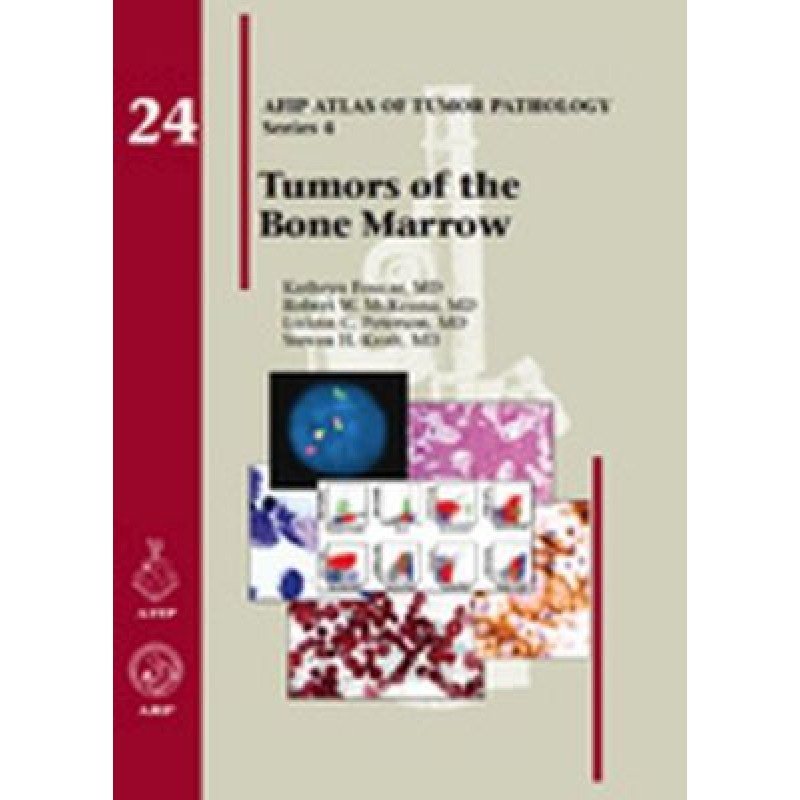 Tumors of the Bone Marrow