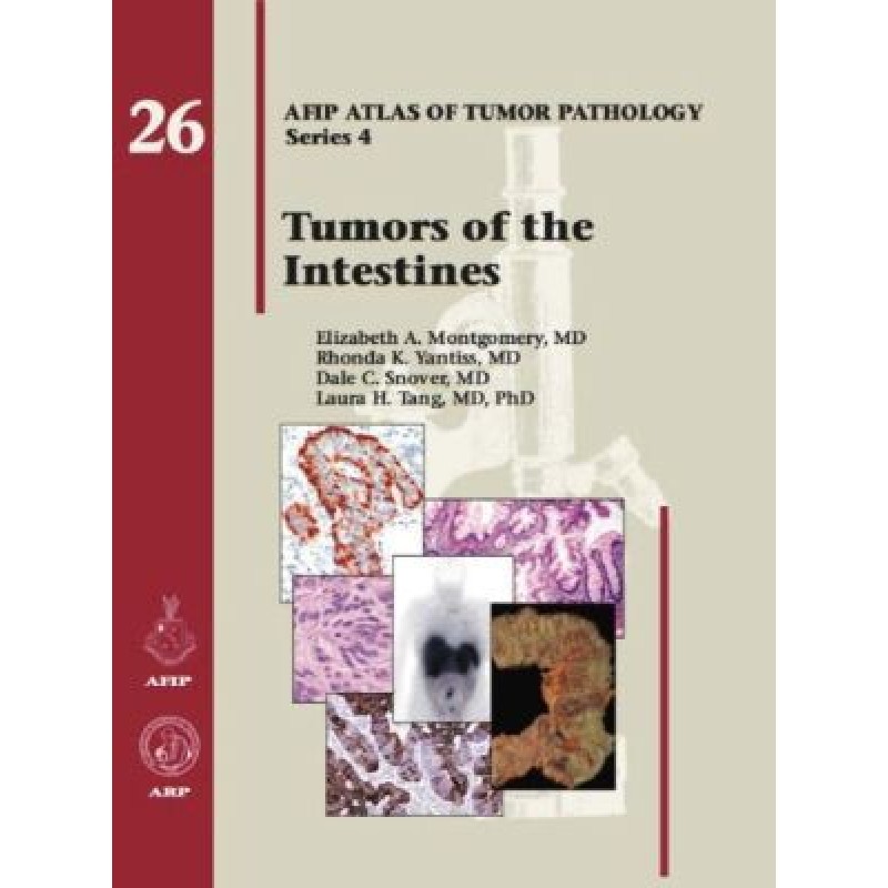 Tumors of the Intestines