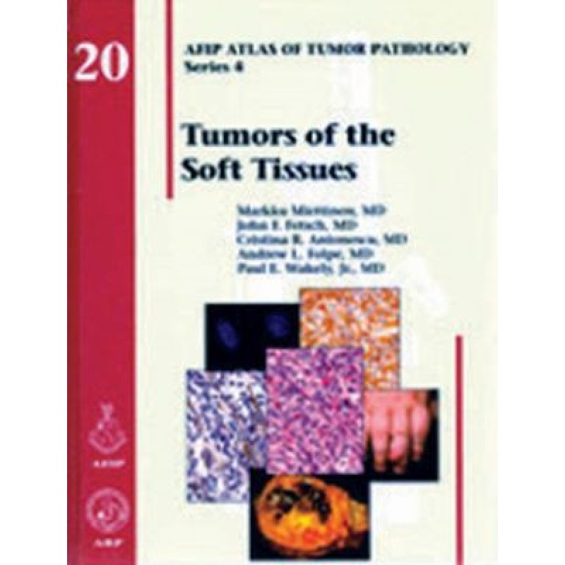 Tumors of the Soft Tissues