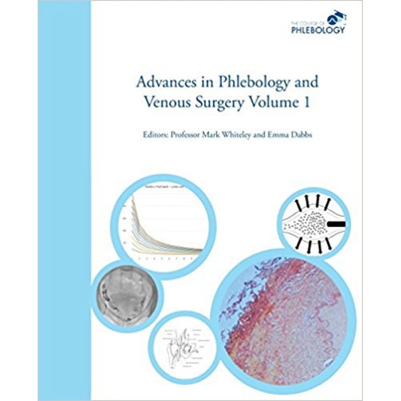 Advances in Phlebology and Venous Surgery Volume 1