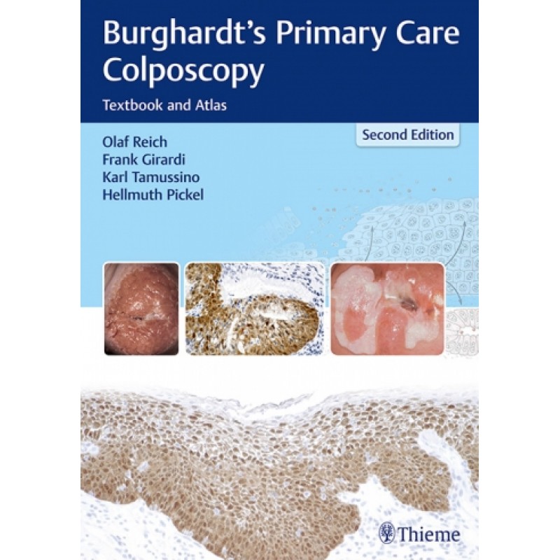 Burghardt's Primary Care Colposcopy Textbook and Atlas 2nd Edition