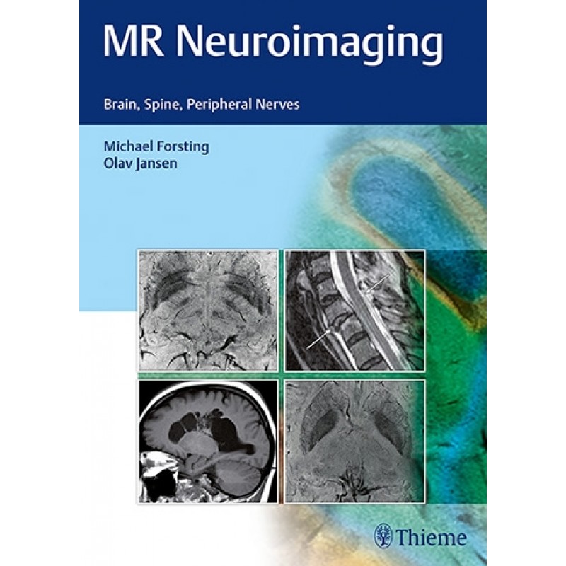 MR Neuroimaging Brain, Spine, and Peripheral Nerves