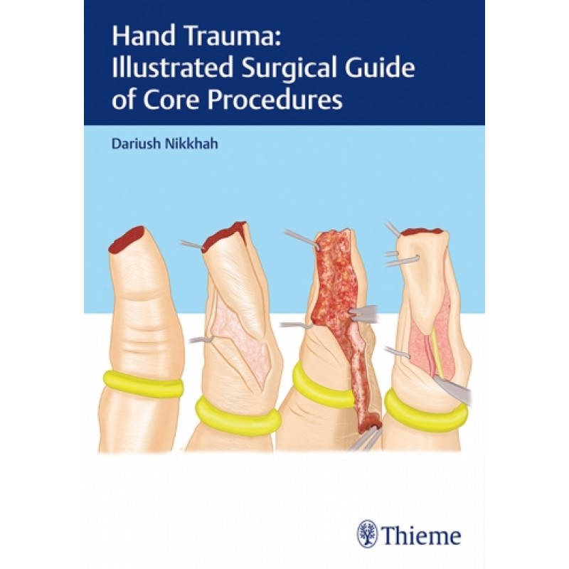 Hand Trauma: Illustrated Surgical Guide of Core Procedures