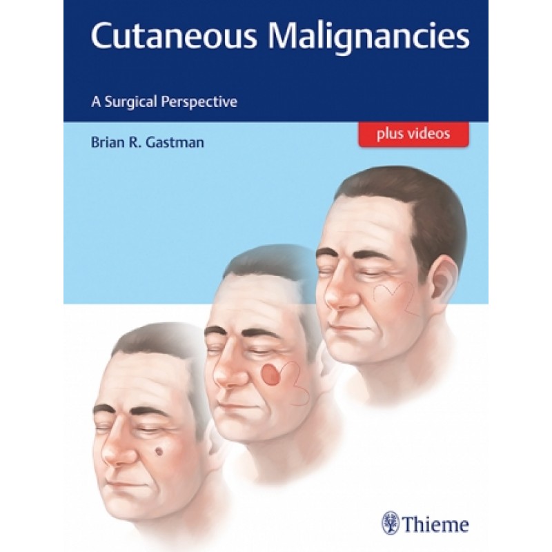 Cutaneous Malignancies A Surgical Perspective