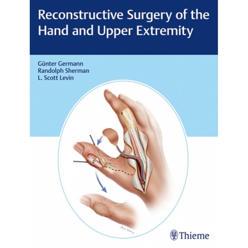 Reconstructive Surgery of the Hand and Upper Extremity