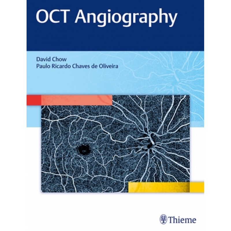 OCT Angiography