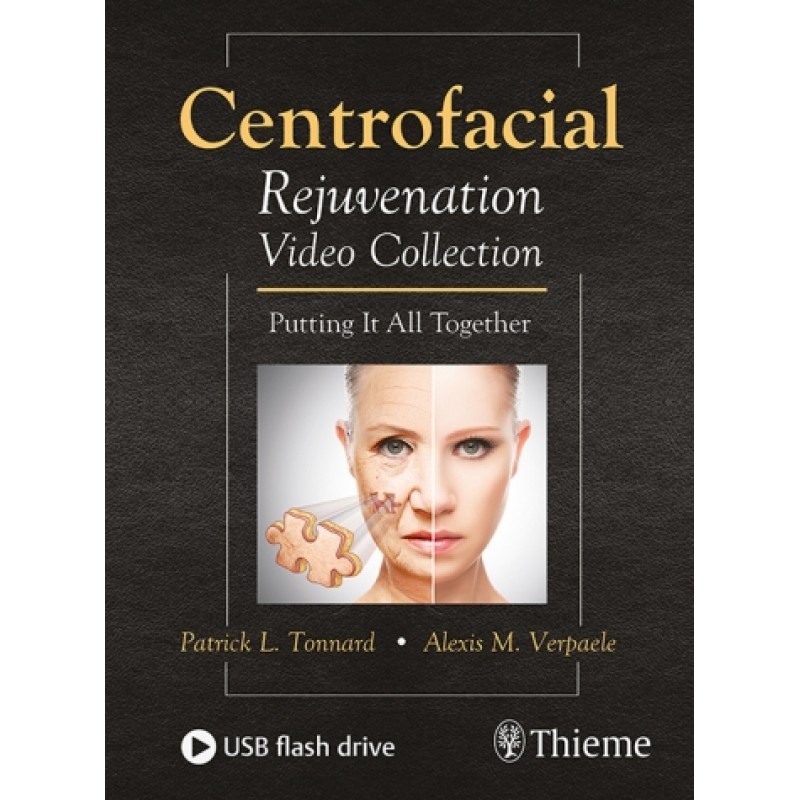 Centrofacial Rejuvenation Video Collection Putting It All Together