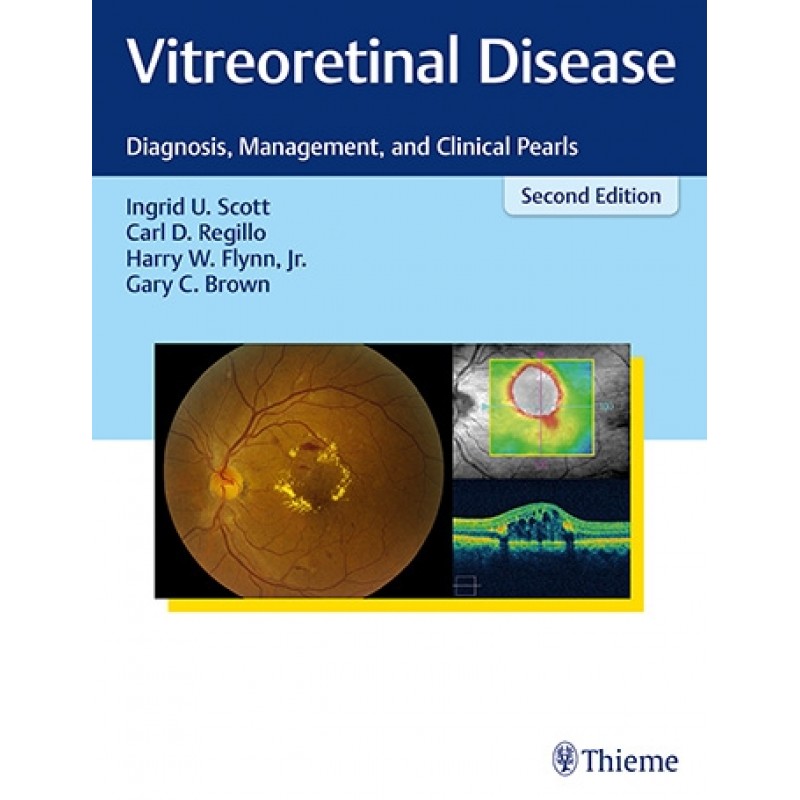 Vitreoretinal Disease Diagnosis, Management, and Clinical Pearls 2nd Edition