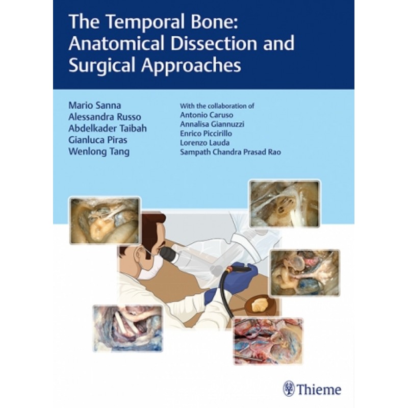 The Temporal Bone Anatomical Dissection and Surgical Approaches