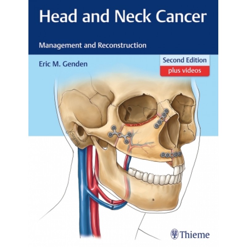 Head and Neck Cancer Management and Reconstruction 2nd Edition