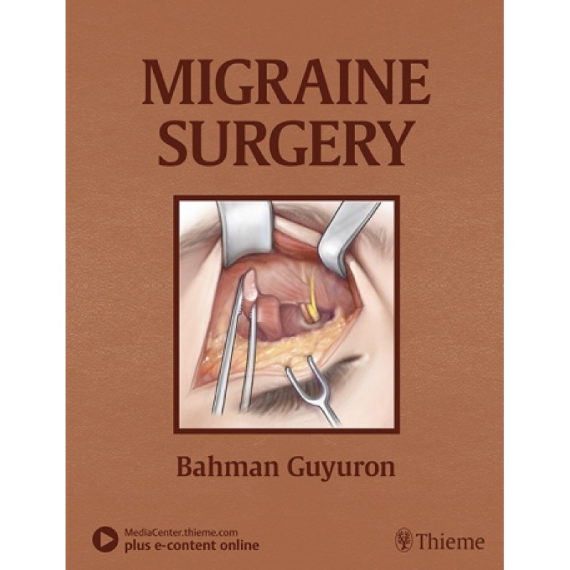 Migraine Surgery