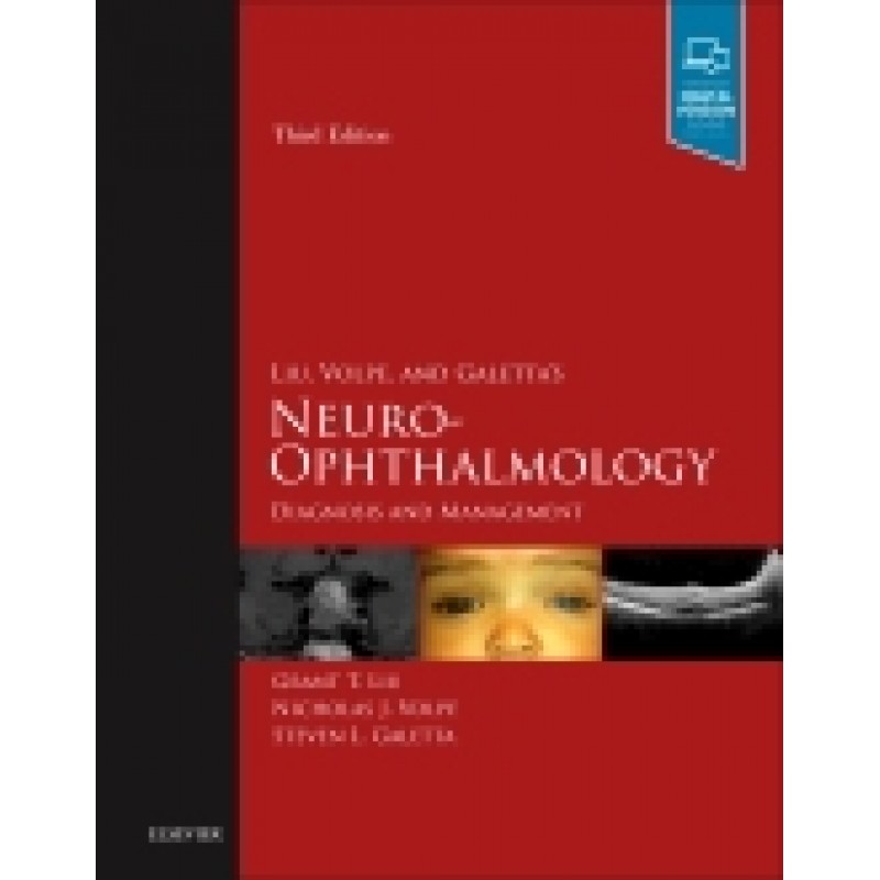 Liu, Volpe, and Galetta’s Neuro-Ophthalmology, 3rd Edition Diagnosis and Management