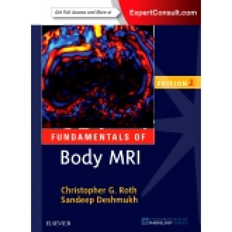 Fundamentals of Body MRI, 2nd Edition