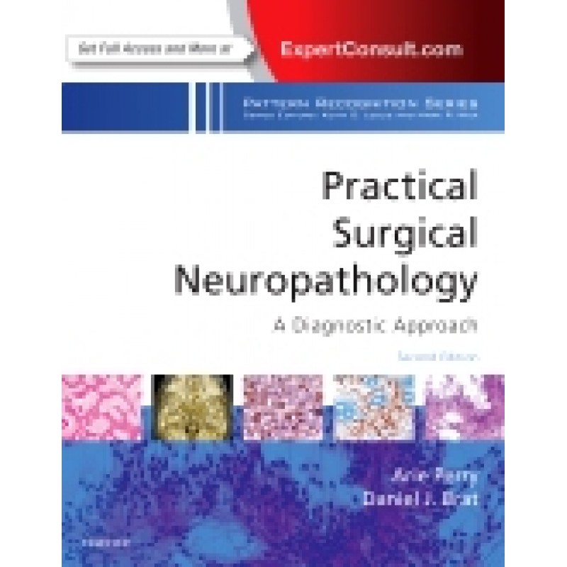 Practical Surgical Neuropathology: A Diagnostic Approach, 2nd Edition A Volume in the Pattern Recognition Series