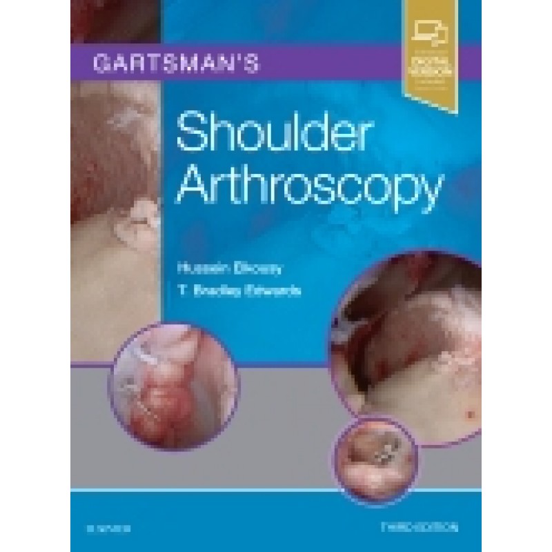 Gartsman's Shoulder Arthroscopy, 3rd Edition