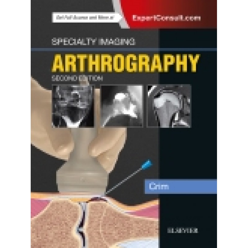 Specialty Imaging: Arthrography, 2nd Edition