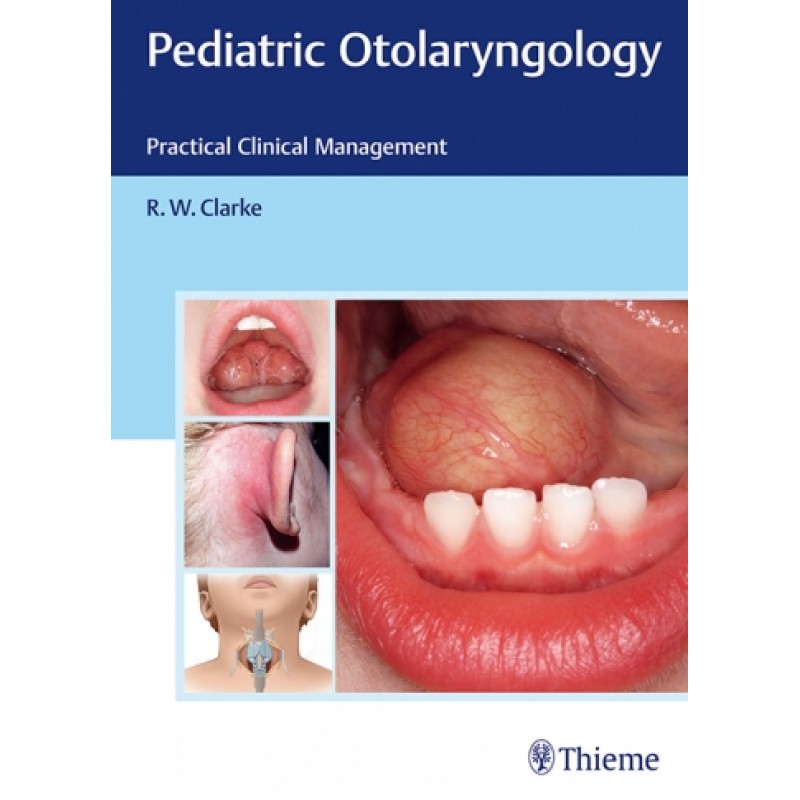 Pediatric Otolaryngology Practical Clinical Management