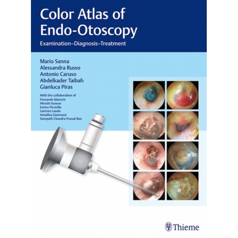 Color Atlas of Endo-Otoscopy Examination-Diagnosis-Treatment