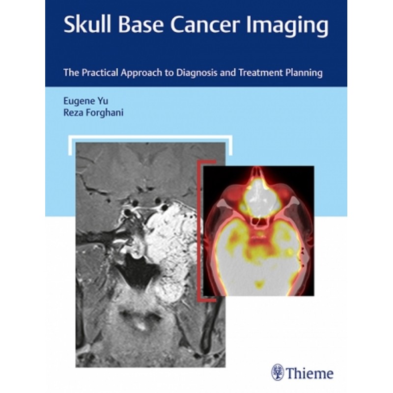 Skull Base Cancer Imaging The Practical Approach to Diagnosis and Treatment Planning