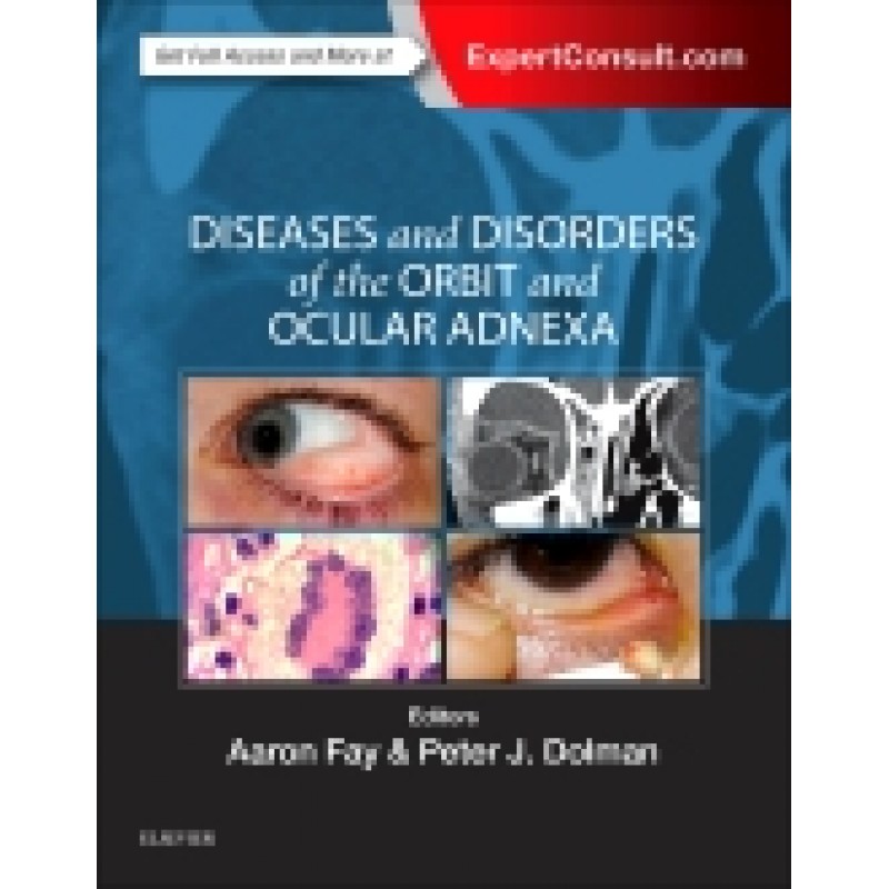 Diseases and Disorders of the Orbit and Ocular Adnexa