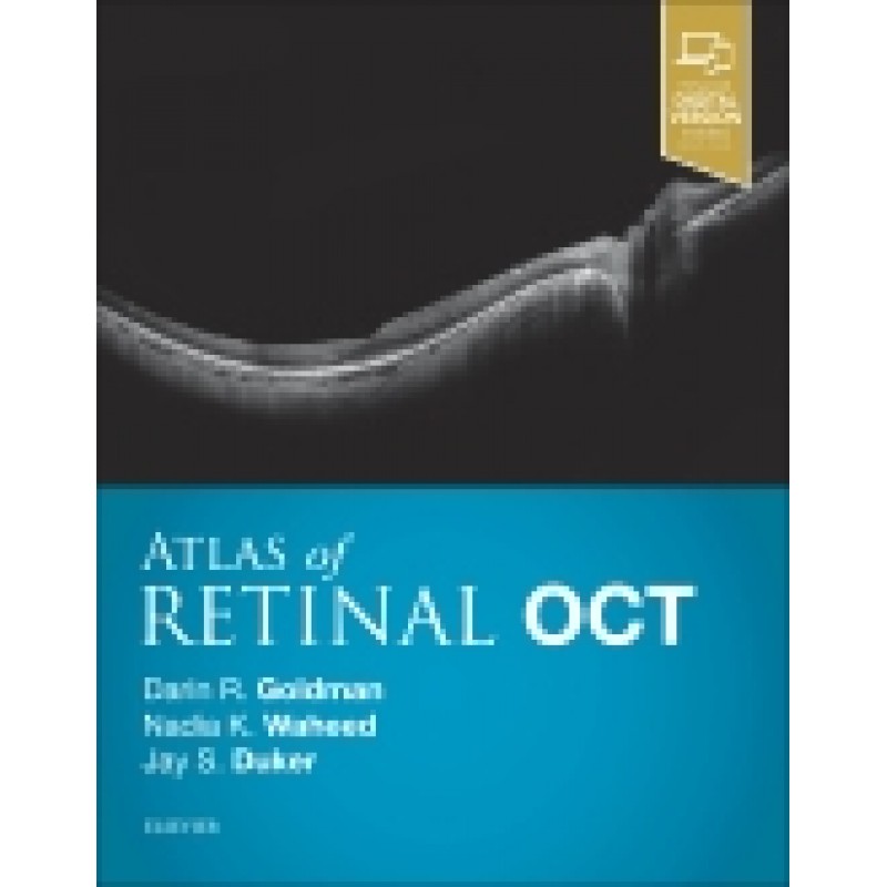 Atlas of Retinal OCT: Optical Coherence Tomography