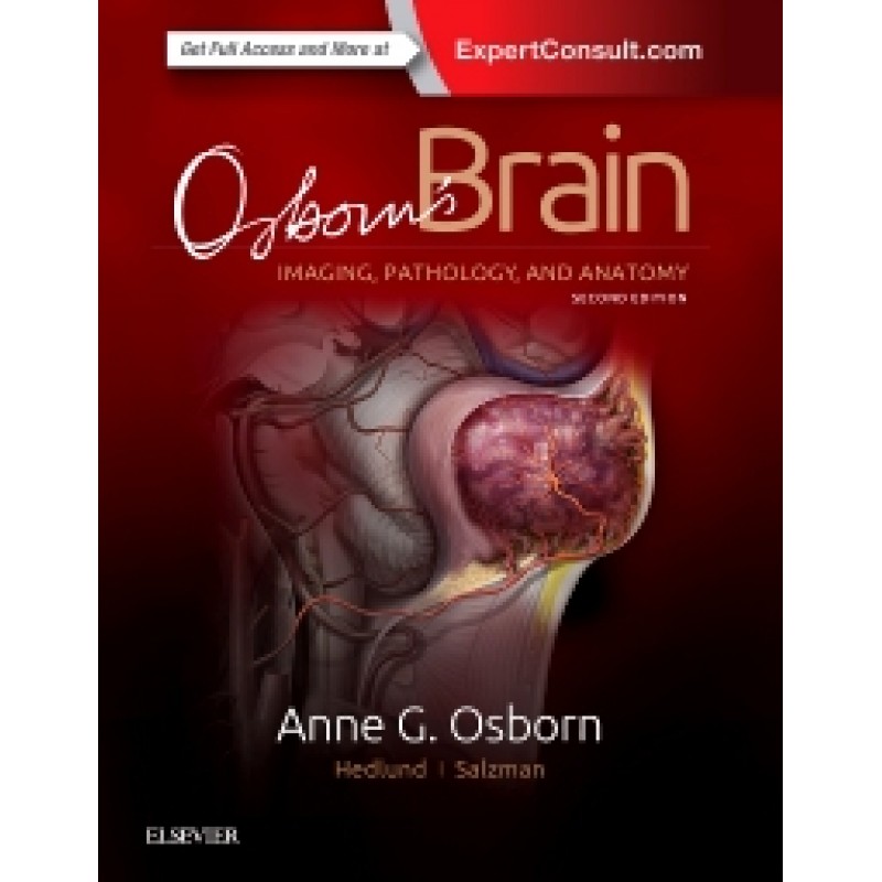 Osborn's Brain, 2nd Edition