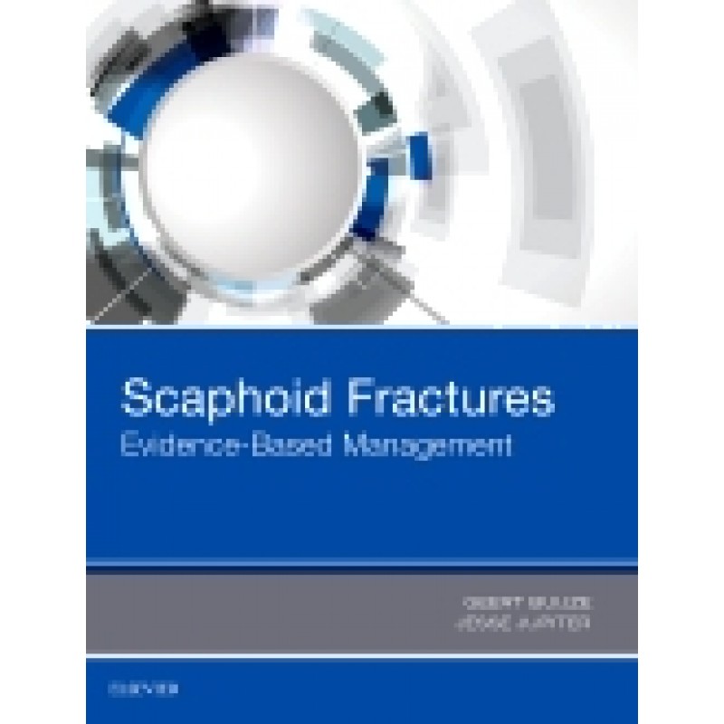 Scaphoid Fractures Evidence-Based Management