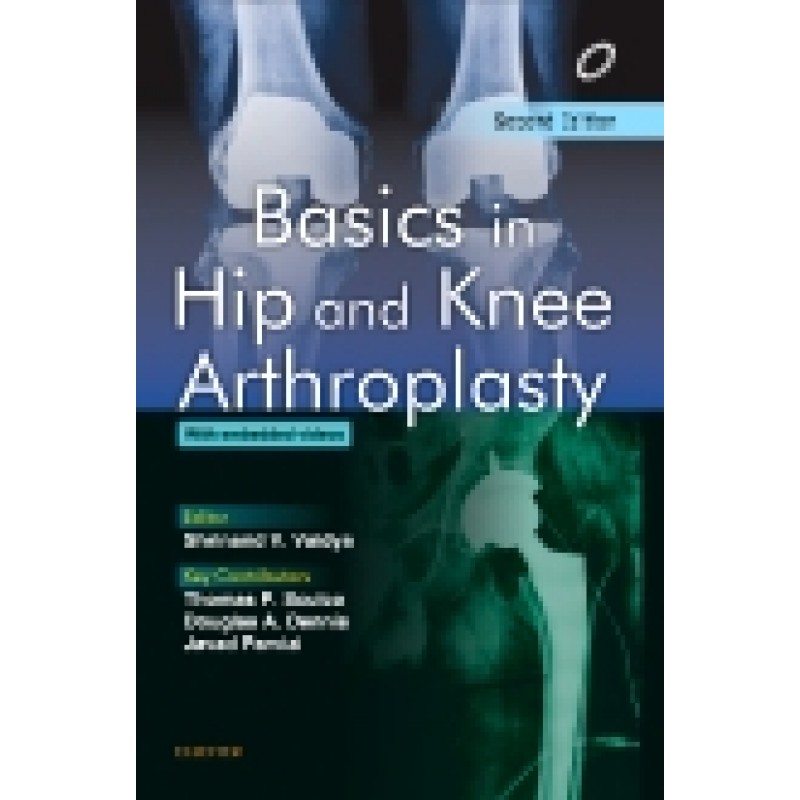 Basics in Hip and Knee Arthroplasty, 2nd Edition